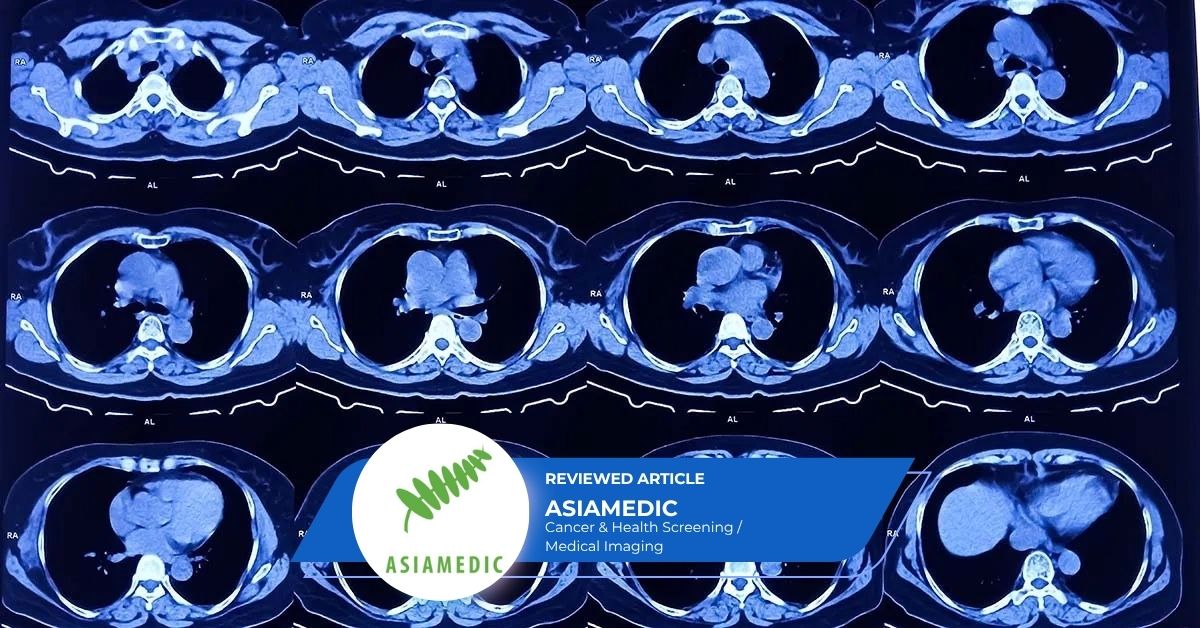 64 Slice CT scan is it sufficient