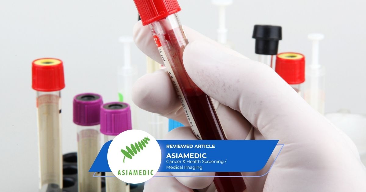 Health365 Guide To Blood Tests For Cancer Screening new