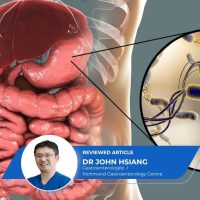 H Pylori Gastric Intestinal Metaplasia Stomach Cancer Risk