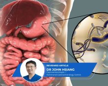 H Pylori Gastric Intestinal Metaplasia Stomach Cancer Risk