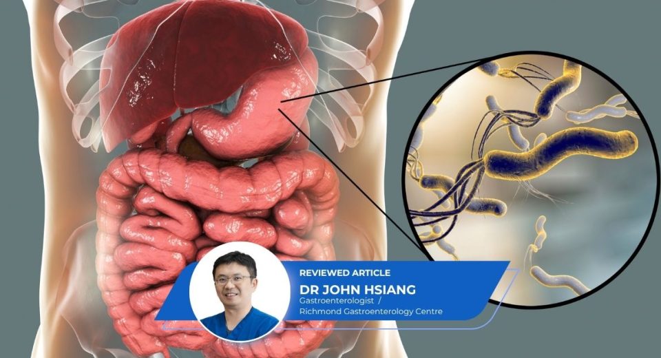 H Pylori Gastric Intestinal Metaplasia Stomach Cancer Risk