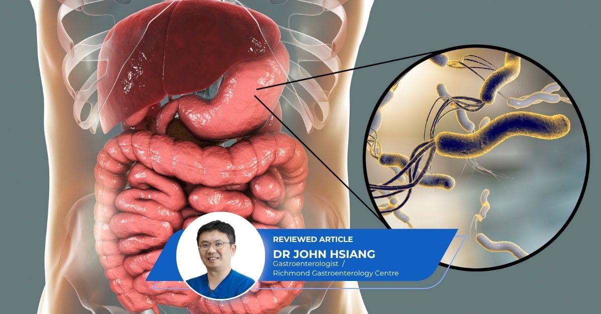 H Pylori Gastric Intestinal Metaplasia Stomach Cancer Risk