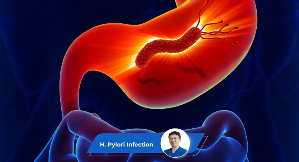 H Pylori Guide Keyart