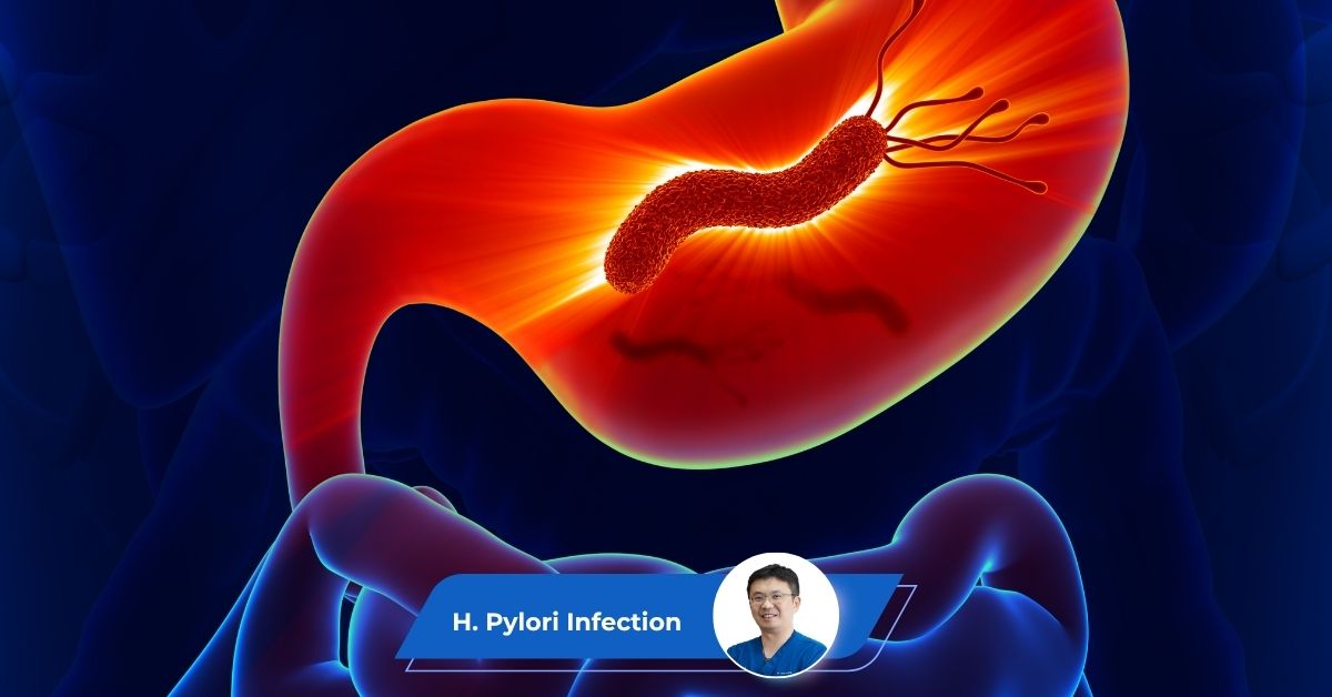 H Pylori Guide Keyart