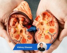 Kidney Disease Guide Keyart
