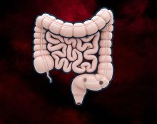 Large colon polyps