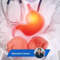 Stomach Cancer Guide Keyart