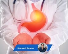 Stomach Cancer Guide Keyart