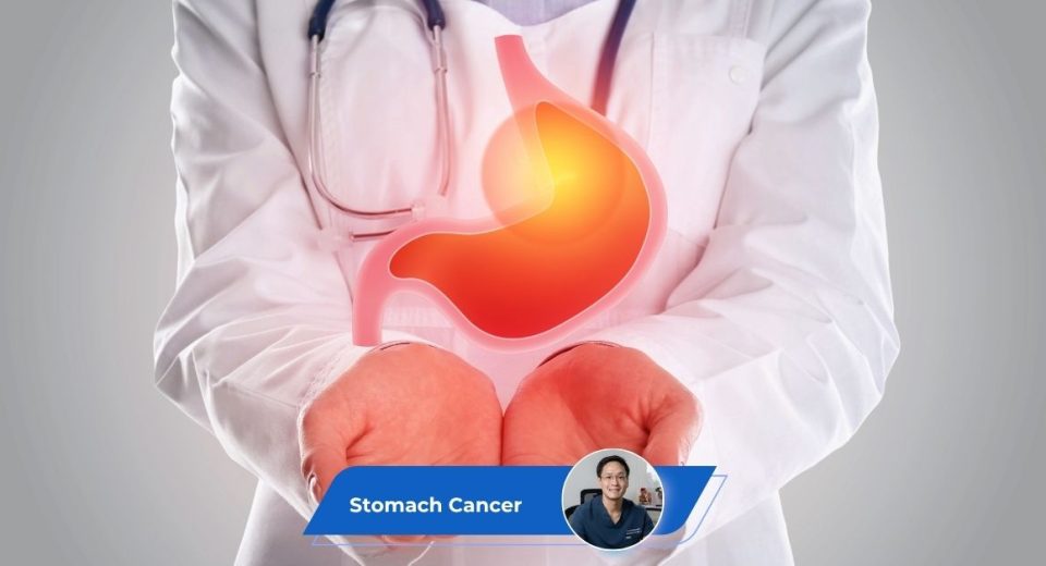 Stomach Cancer Guide Keyart